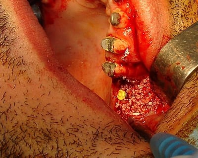 Dsc05407 cb0ins - Eugenol