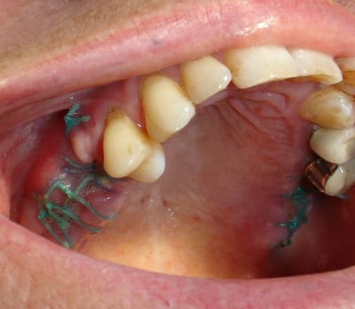 Dsc05605 p3hf7b - Eugenol