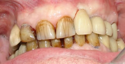 Dsc05650 ppxvea - Eugenol