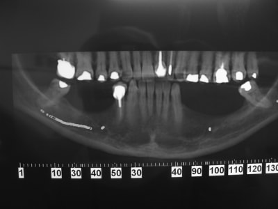 Dsc05914 ilojxe - Eugenol