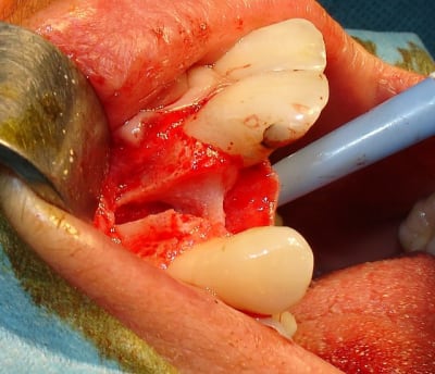 Dsc06144 dybpqo - Eugenol