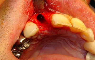 Dsc09761 dnl6rm - Eugenol