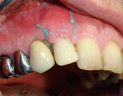 Dsc09841 skwnks - Eugenol