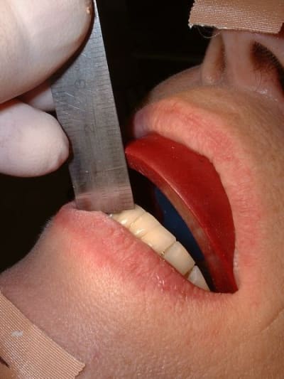 Dscf0007  800x600  efkhqt - Eugenol