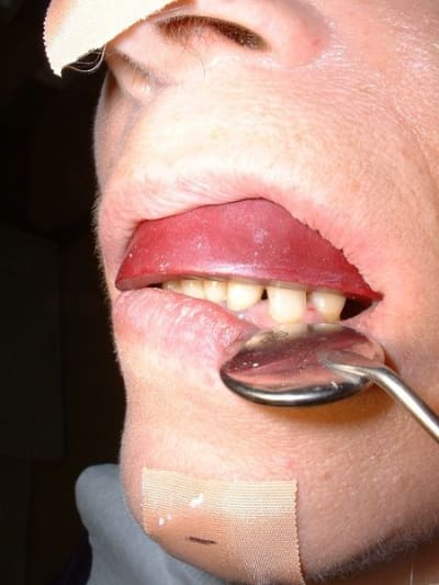 Dscf0012  800x600  tccu1m - Eugenol