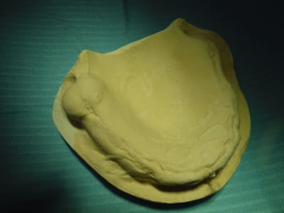 Dscf0338 yv3ygn - Eugenol