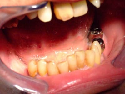 Dscf0547 jsdbg9 - Eugenol