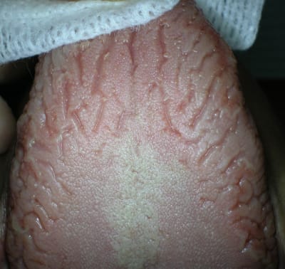 Dscn0926 mjgjrn - Eugenol