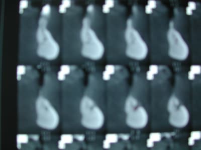Dscn1323 yq8rzg - Eugenol