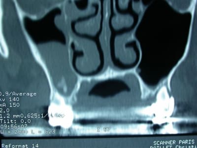 Dscn2064 fm6ymi - Eugenol