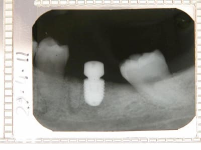 Dscn2376 proper f0xnjx - Eugenol