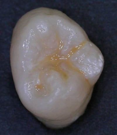 Dscn2458w5 v6ktl9 - Eugenol