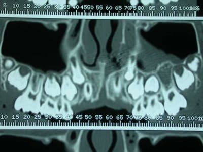 Dscn2557 gkd8bx - Eugenol