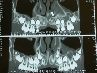 Dscn2563 ln6wfl - Eugenol