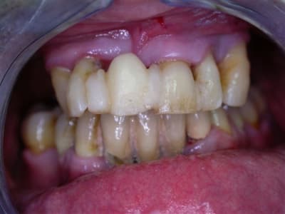 Dscn2620 gnb4kb - Eugenol