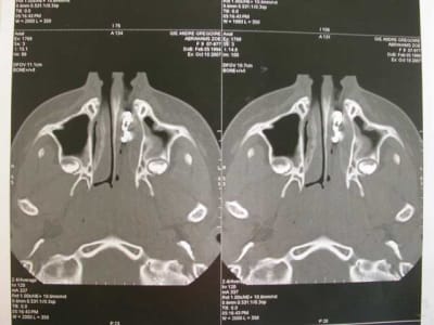 Dscn2654 iktgid - Eugenol