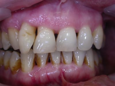 Dscn3572 ki9ppu - Eugenol