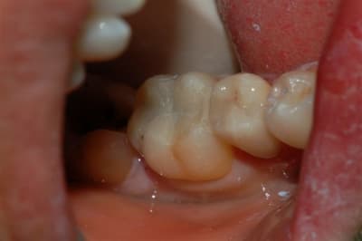 Dsc 0001 nv4hay - Eugenol