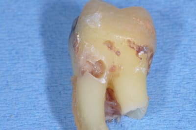 Dsc 0003  2  brgyqo - Eugenol