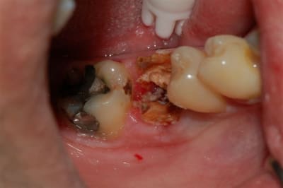 Dsc 0005 icnarv - Eugenol