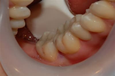 Dsc 0006 n1kbxy - Eugenol