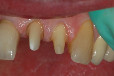 Dsc 0009 jxsegm - Eugenol