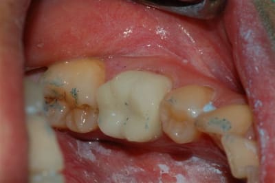 Dsc 0014 vozp5d - Eugenol