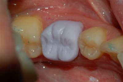 Dsc 0015 m2d4po - Eugenol