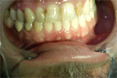 Dsc 0019 md8dzu - Eugenol