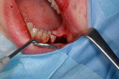 Dsc 0040 evhbd5 - Eugenol