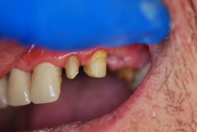 Dsc 0058 2 nupjk1 - Eugenol