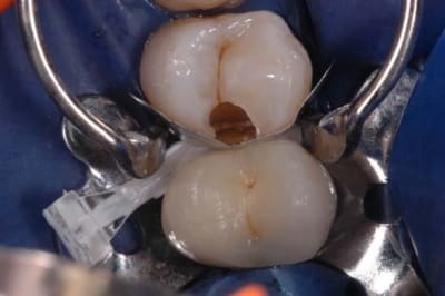 Dsc 0074 copier icp8zd - Eugenol
