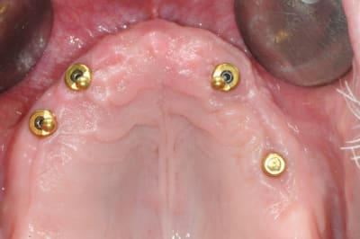 Dsc 0091 habv4h - Eugenol
