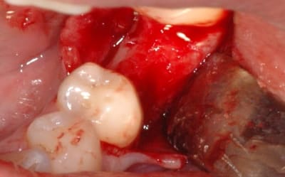 Dsc 0097 cfe94x - Eugenol