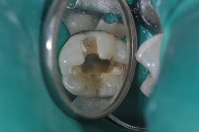 Dsc 0103  2  qlnw88 - Eugenol