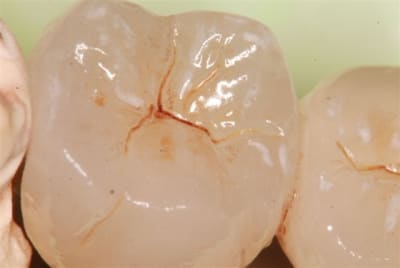 Dsc 0109 umpgfe - Eugenol