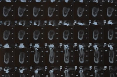 Dsc 0112 poh9p5 - Eugenol