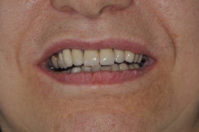 Dsc 0293 eelo63 - Eugenol