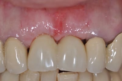 Dsc 0321 cblvsi - Eugenol