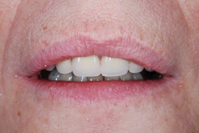 Dsc 0333 lmz5az - Eugenol