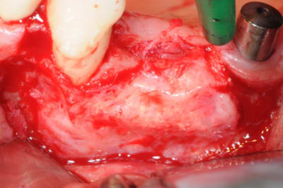 Dsc 0353 s5qe8i - Eugenol