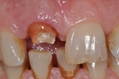 Dsc 0353 tfkf57 - Eugenol