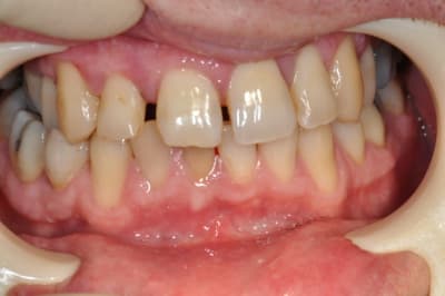 Dsc 0384 lwuipi - Eugenol