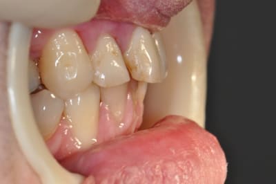 Dsc 0385 zw9xbe - Eugenol