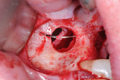 Dsc 0391 sry4dv - Eugenol