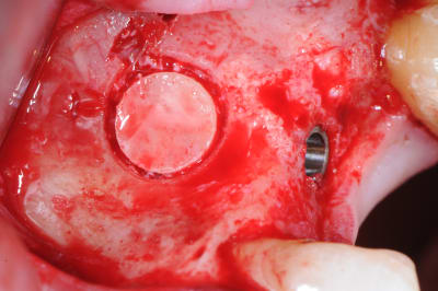 Dsc 0401 lneimz - Eugenol