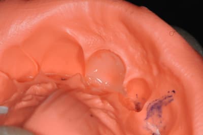 Dsc 0473 kxcvsr - Eugenol