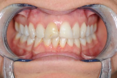 Dsc 0520 uijfsk - Eugenol