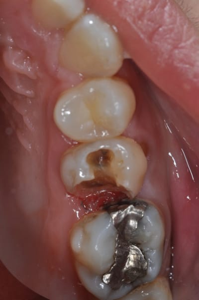 Dsc 0561 tv1mdz - Eugenol