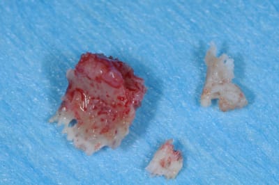 Dsc 0609 geljrq - Eugenol